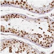 IHC-P analysis of human testis tissue, using MAGEF1 Antibody (1/100 dilution).