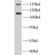 WB analysis of mouse kidney tissue, using MAGI1 antibody (1/500 dilution).