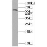 WB analysis of PC-3 cells, using MAK antibody (1/800 dilution).