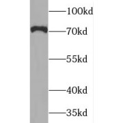 WB analysis of human placenta tissue, using MAN1A2 antibody (1/200 dilution).
