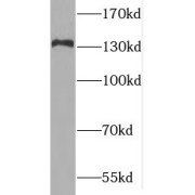 WB analysis of mouse testis tissue, using MAN2B2 antibody (1/300 dilution).
