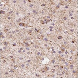 Monoamine Oxidase B (MAOB) Antibody
