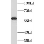 WB analysis of human liver tissue, using MAOB antibody (1/300 dilution).