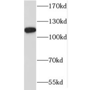WB analysis of human brain tissue, using MAP1S antibody (1/1000 dilution).