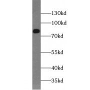 WB analysis of SH-SY5Y cells, using MAP2 antibody (1/1000 dilution).