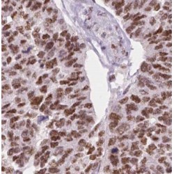 MEK Kinase Kinase 5 (MAP4K5) Antibody