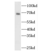 WB analysis of mouse brain tissue, using MAPK4 antibody (1/1000 dilution).