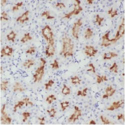 Target Of Rapamycin Complex 2 Subunit MAPKAP1 (MAPKAP1) Antibody