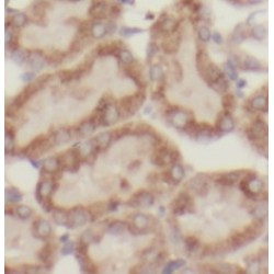 MAP Kinase-Activated Protein Kinase 2 (MAPKAPK2) Antibody