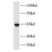 WB analysis of HeLa cells, using MAPKAPK5 antibody (1/1000 dilution).