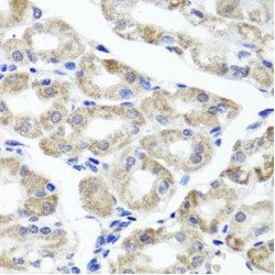 Mitogen-Activated Protein Kinase-Binding Protein 1 (MAPKBP1) Antibody