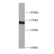 WB analysis of mouse liver tissue, using MAPKBP1 antibody (1/300 dilution).