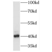 WB analysis of K-562 cells, using MAPRE2 antibody (1/1000 dilution).