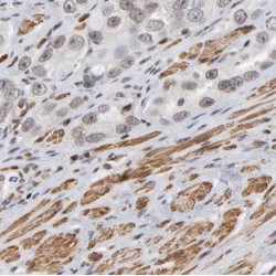 Myristoylated Alanine-Rich C-Kinase Substrate (Marcks) Antibody