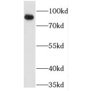 WB analysis of mouse brain tissue, using Marcks antibody (1/2000 dilution).