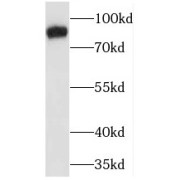 WB analysis of mouse brain tissue, using Marcks antibody (1/2000 dilution).