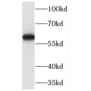 WB analysis of mouse brain tissue, using Marcksl1 antibody (1/500 dilution).