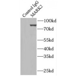 Serine/Threonine-Protein Kinase MARK2 (MARK2) Antibody