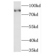 WB analysis of mouse brain tissue, using MARK2 antibody (1/1000 dilution).