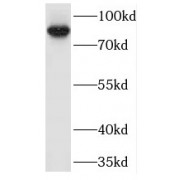 WB analysis of human brain tissue, using MARK3 antibody (1/200 dilution).