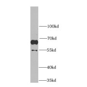 WB analysis of HeLa cells, using MARVELD2 antibody (1/1000 dilution).