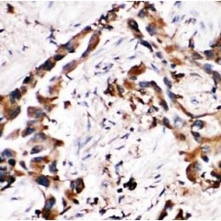 Methionine Adenosyltransferase II Beta (MAT2B) Antibody