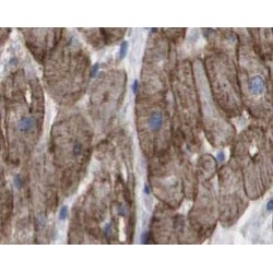 MAVS; VISA Antibody