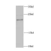 WB analysis of MCF7 cells, using MAX antibody (1/1000 dilution).