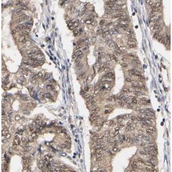 Methyl-CpG Binding Domain Protein 3 (MBD3) Antibody