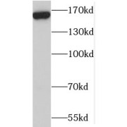 WB analysis of mouse heart tissue, using MBD5 antibody (1/500 dilution).