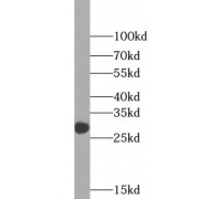WB analysis of human blood tissue, using MBL2 antibody (1/1000 dilution).
