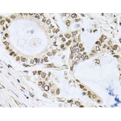 Induced Myeloid Leukemia Cell Differentiation Protein (MCL1) Antibody