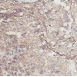 Induced Myeloid Leukemia Cell Differentiation Protein (MCL1) Antibody