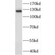 WB analysis of K-562 cells, using MCM2 antibody (1/1000 dilution).