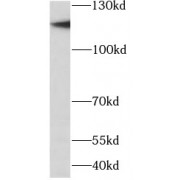 WB analysis of K-562 cells, using MCM2 antibody (1/2000 dilution).