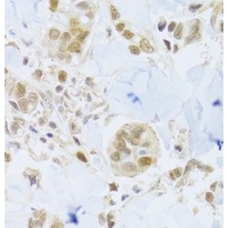 Minichromosome Maintenance Deficient 4 (MCM4) Antibody