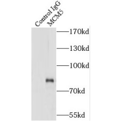 Minichromosome Maintenance Deficient 5 (MCM5) Antibody