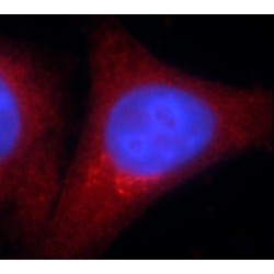 Malate Dehydrogenase 1 (MDH1) Antibody
