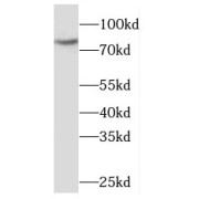 WB analysis of HeLa cells, using MDMX antibody (1/500 dilution).