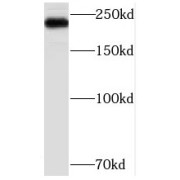 WB analysis of mouse liver tissue, using MED12 antibody (1/800 dilution).