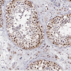 Mediator Complex Subunit 19 (MED19) Antibody