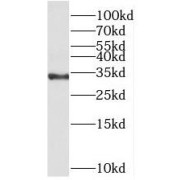 WB analysis of A431 cells, using MED6 antibody (1/1000 dilution).