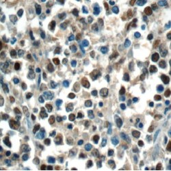Protein MEF2BNB (MEF2BNB) Antibody