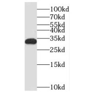 WB analysis of human brain tissue, using MEF2BNB antibody (1/1000 dilution).