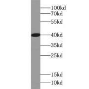 WB analysis of mouse brain, using MEK1 antibody (1/1000 dilution).