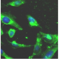 Dual Specificity Mitogen-Activated Protein Kinase Kinase 3 (MEK3) Antibody