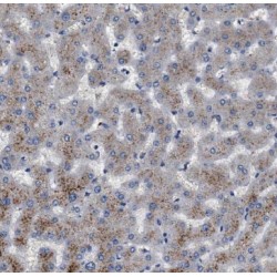Dual Specificity Mitogen-Activated Protein Kinase Kinase 3 (MEK3) Antibody