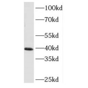 WB analysis of HeLa cells, using MEK3 antibody (1/600 dilution).