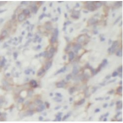 Dual Specificity Mitogen-Activated Protein Kinase Kinase 4 (MEK4) Antibody