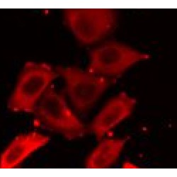 Dual Specificity Mitogen-Activated Protein Kinase Kinase 5 (MEK5) Antibody